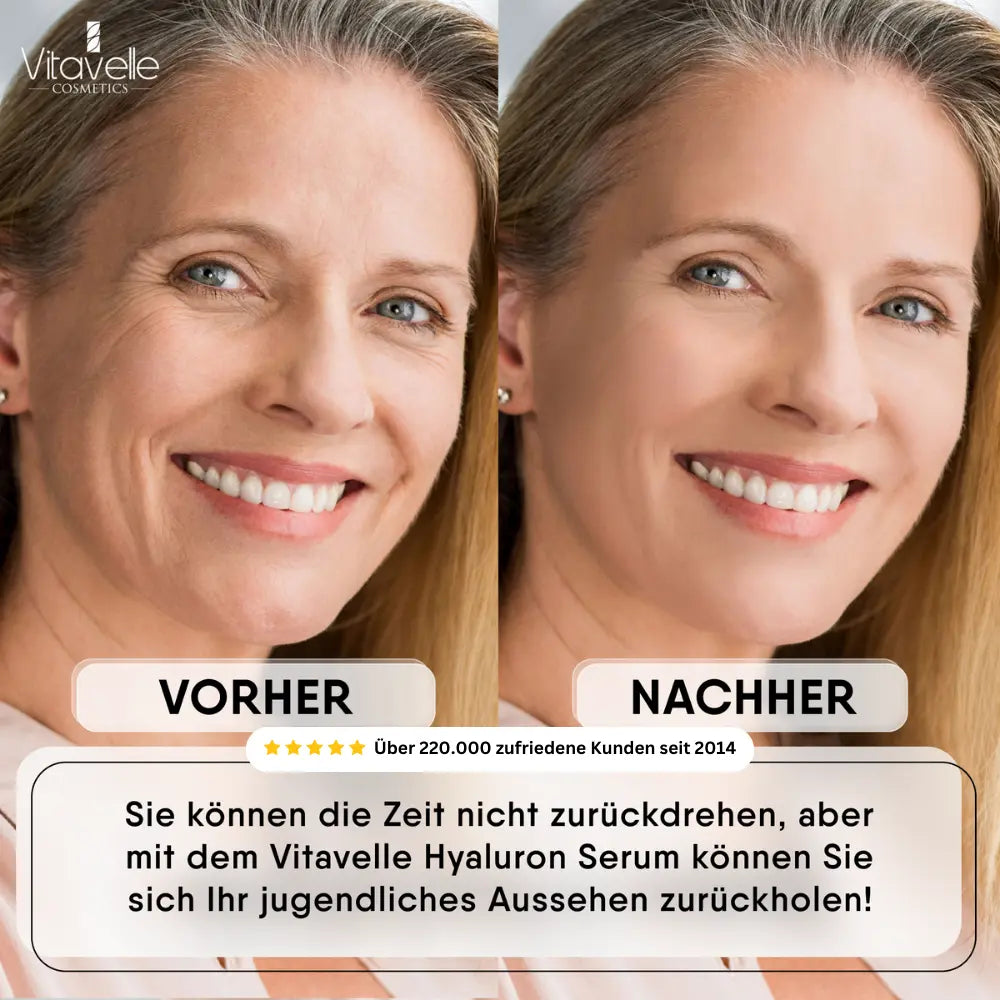 Hyaluronsäure Serum mit Aloe Vera