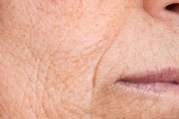 Visible signs of skin aging? We have the solution