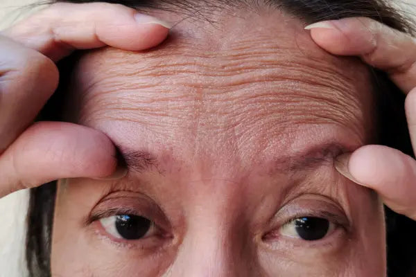Wrinkles: How they develop and what you can do about them