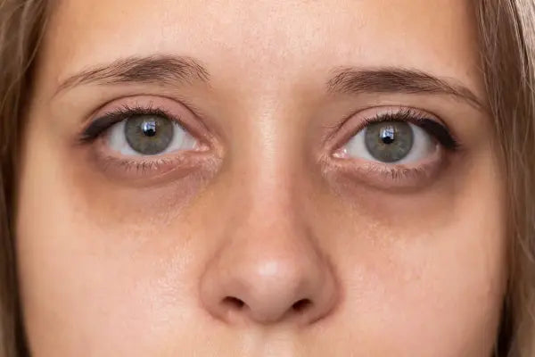 Tired eyes? We have the solution!