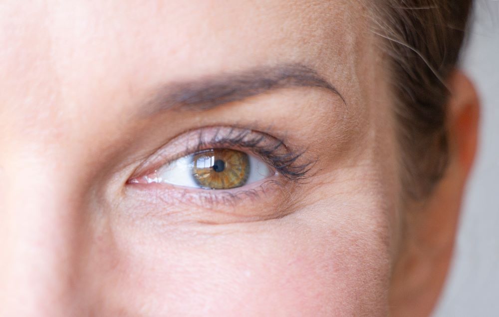 What to do about wrinkles under the eyes?