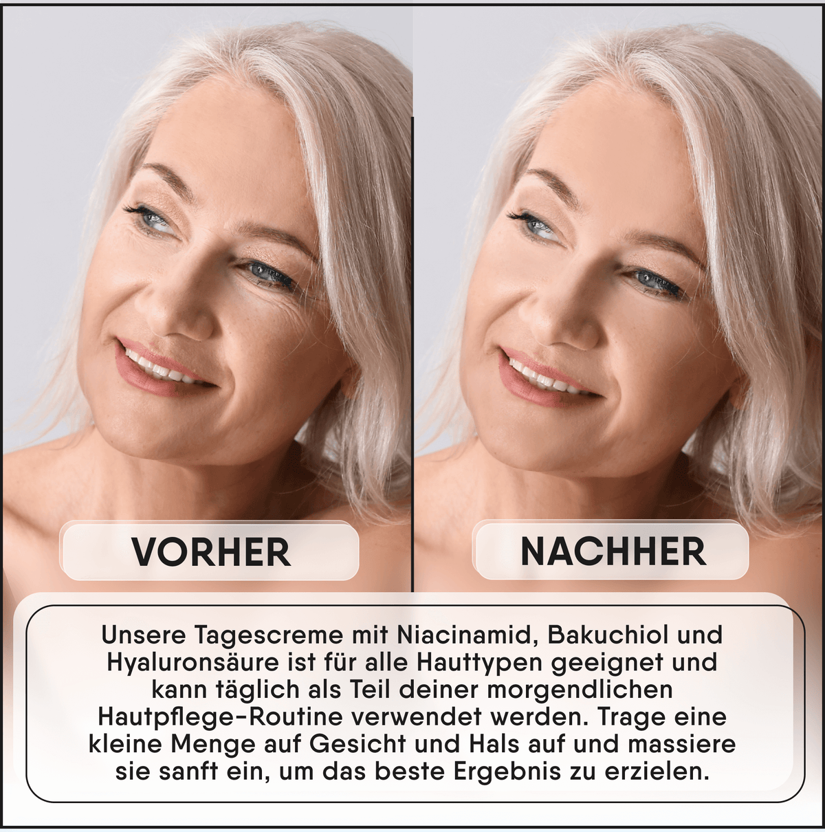 Dagcreme med niacinamider