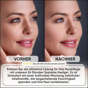 Naturligt Botulin Serum - 24 timers Supreme Skin Gel - Det naturlige Botox-serum