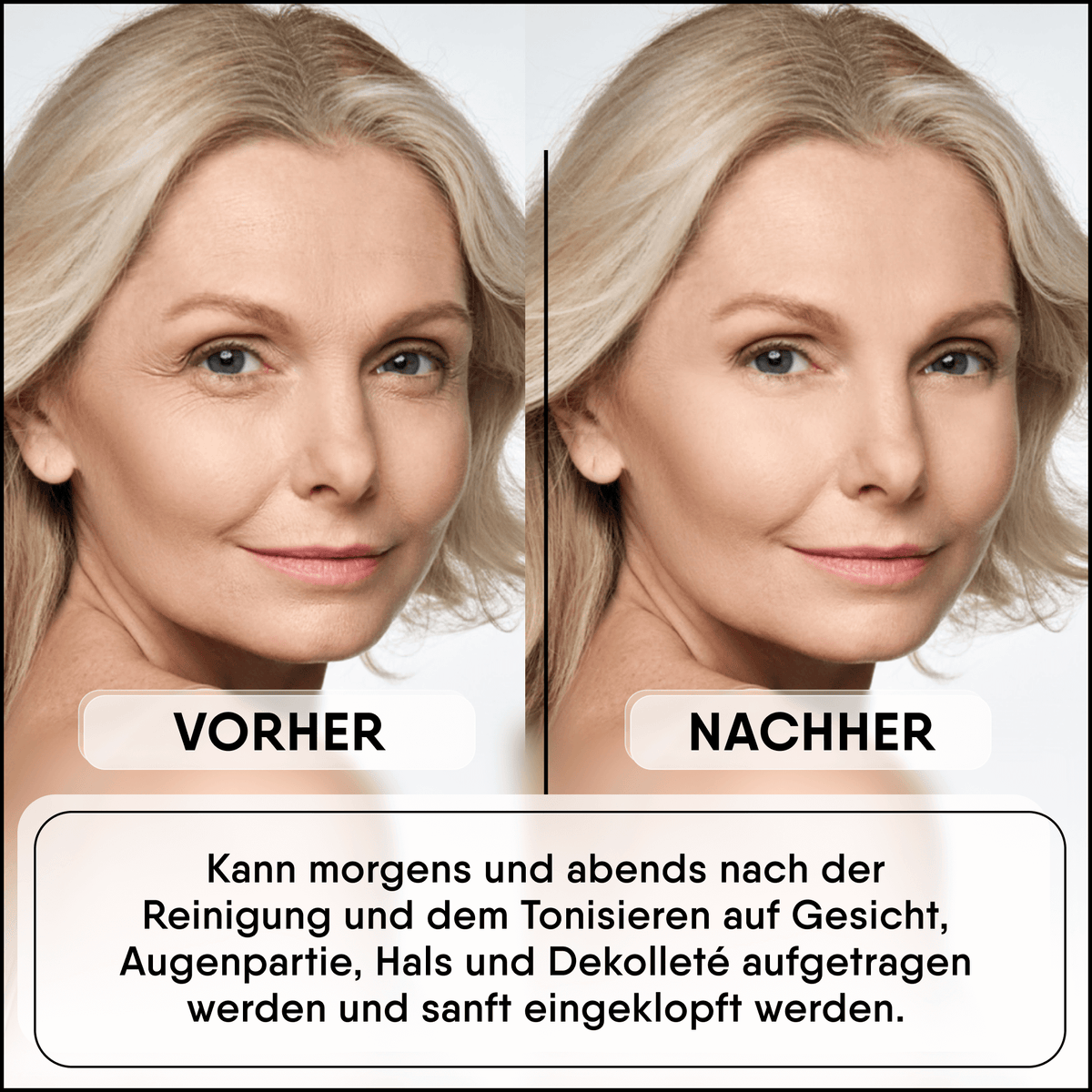 Snail Mucin Concentrate - Højt koncentreret