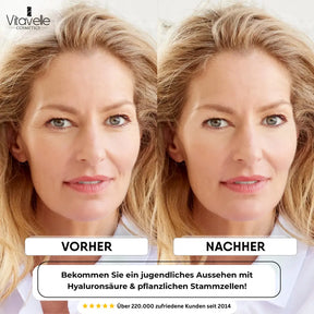 Stem Cell Anti-Aging Cream