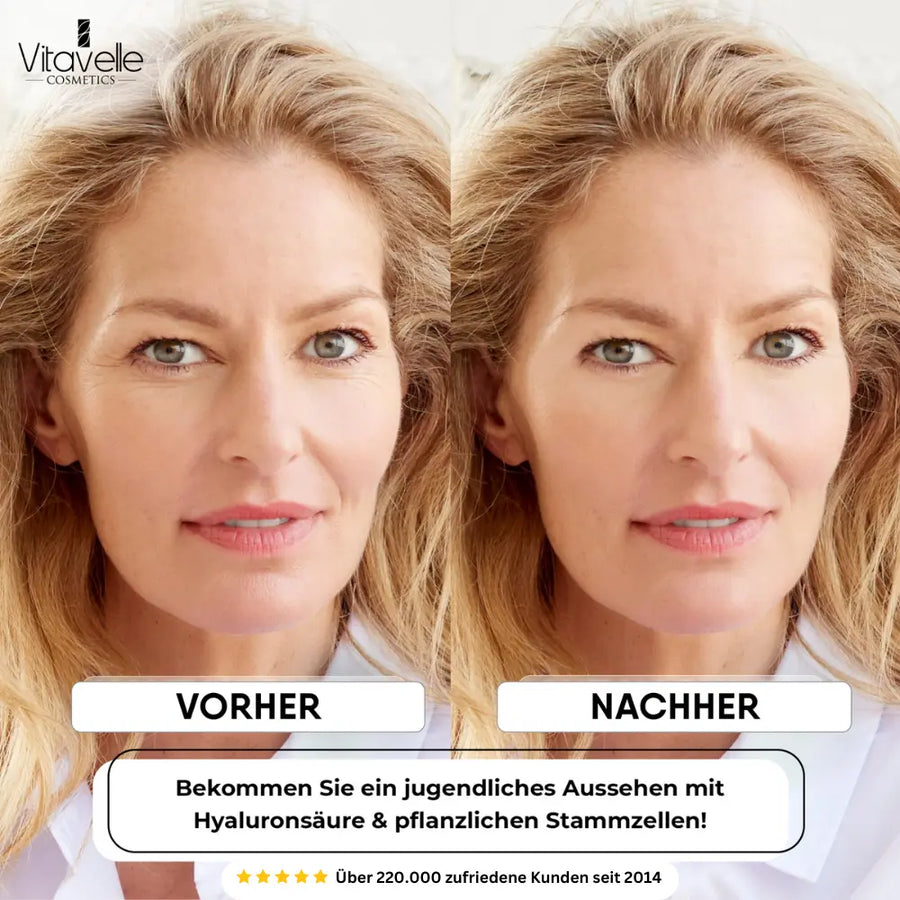 Stem Cell Anti-Aging Cream
