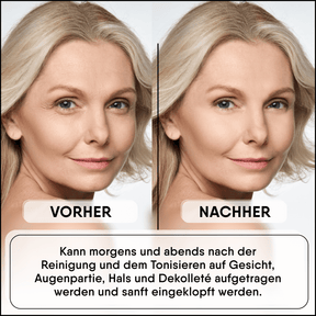 Snail Mucin Concentrate - Highly concentrated
