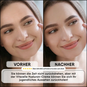 Hyaluronic acid cream with shea butter