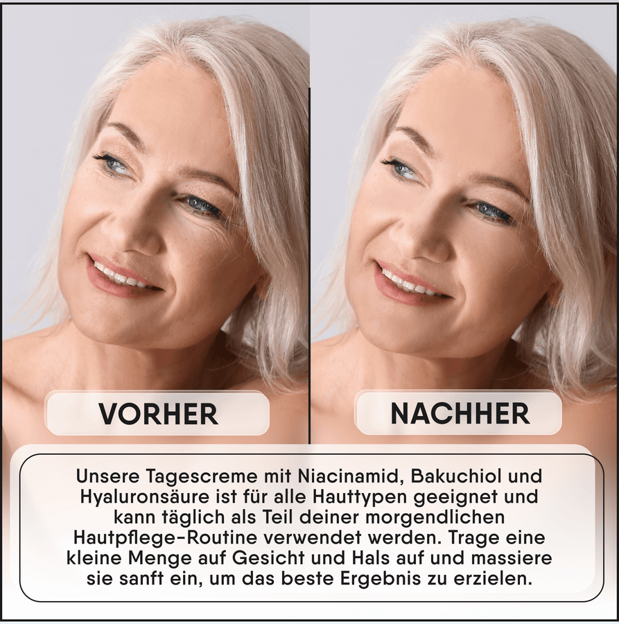 Dagcrème met niacinamiden