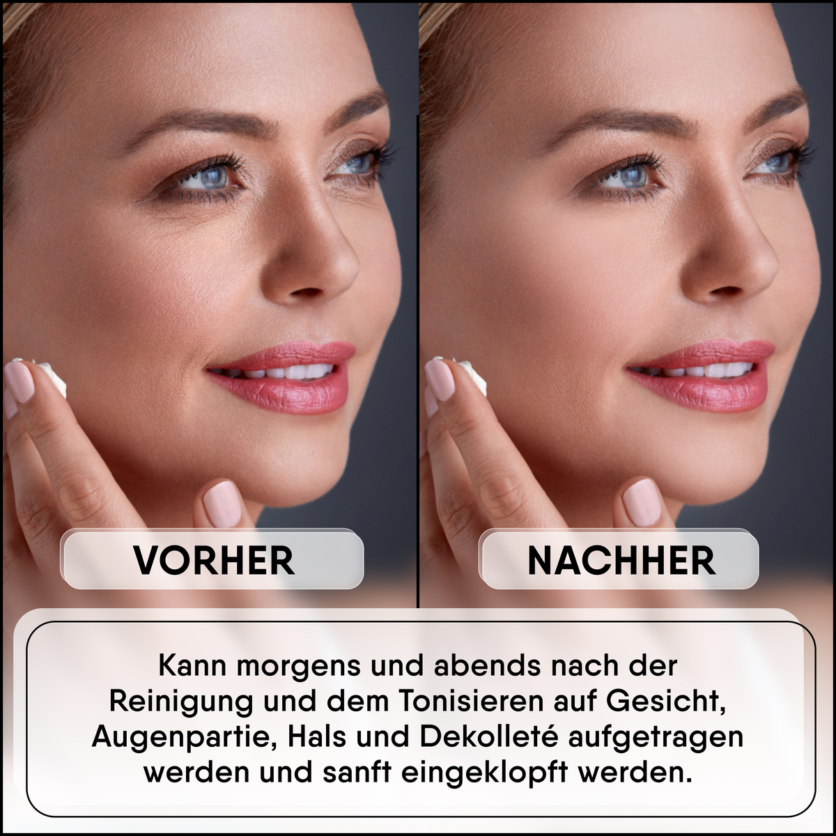 Crème van slakkenslijm