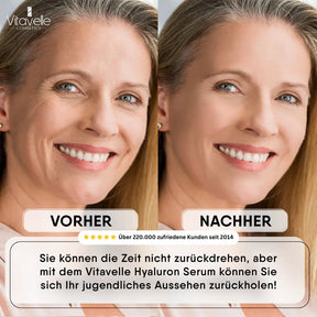 Hyaluronzuurserum met aloë vera