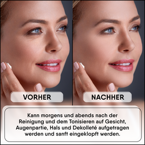 Snigel Mucin Cream